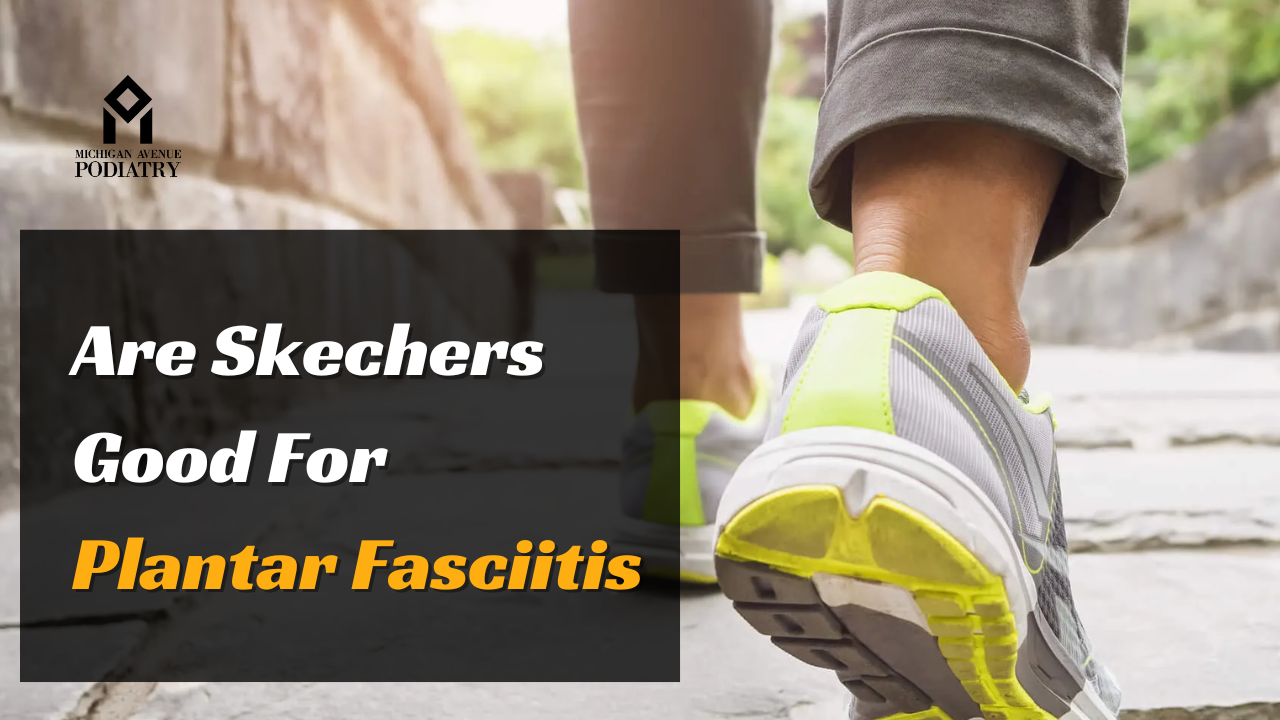 You are currently viewing Are Skechers Good For Plantar Fasciitis? Let’s Find Out