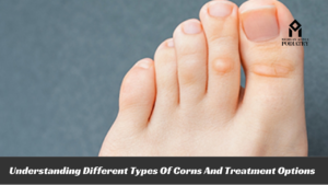 Read more about the article Understanding Different Types Of Corns And Treatment Options