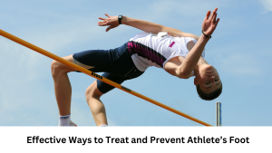 Read more about the article Effective Ways to Treat and Prevent Athlete’s Foot: Tips and Treatments