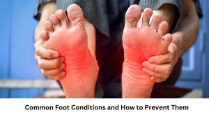 Read more about the article Common Foot Conditions and How to Prevent Them