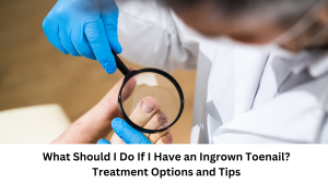 Read more about the article What Should I Do If I Have an Ingrown Toenail? Treatment Options and Tips